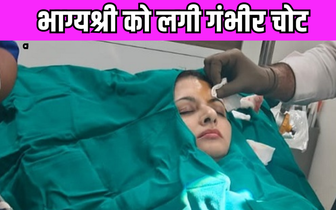 होली के मौके पर Bhagyashree हुईं घायल, आनन-फानन में एक्ट्रेस को करानी पड़ी सर्जरी